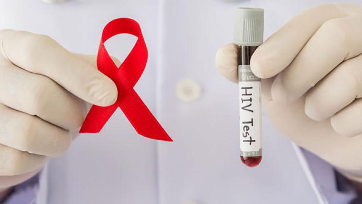 hiv-test