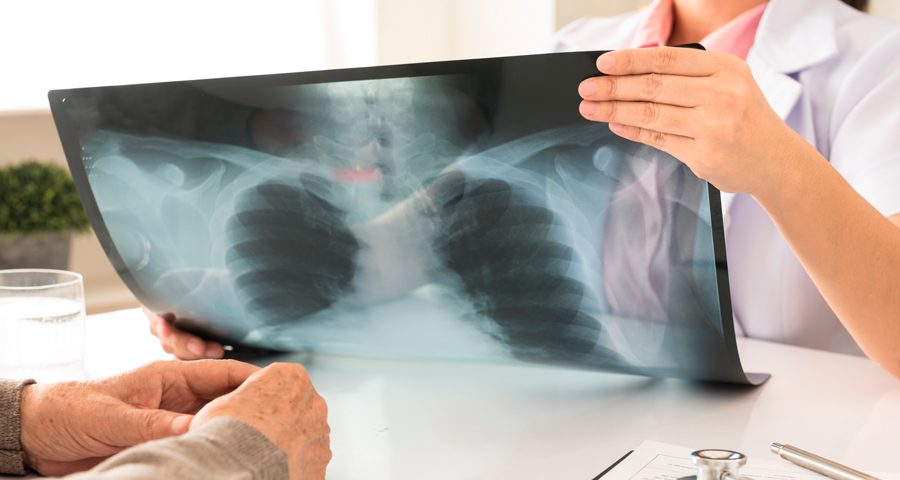 Actualpacs-radiologia-centrada-en-el-paciente-900x480